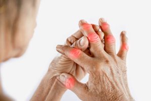 Arthrovia pareri - forum, pareri reale ale utilizatorilor 